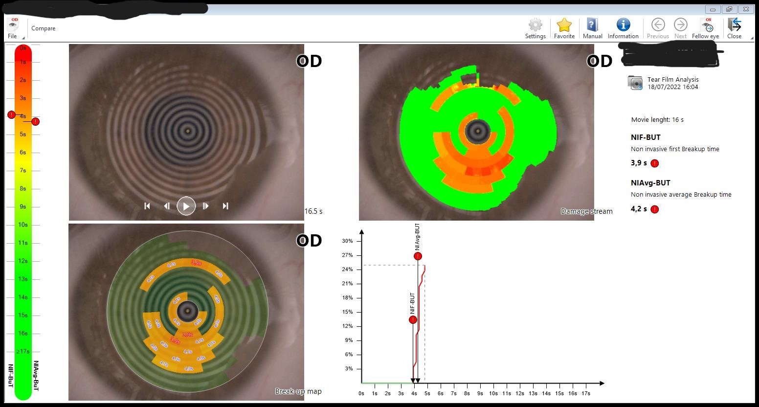 anonp0654693148t16 03 43od