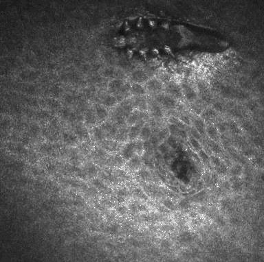 demodex near mg 1684334485377