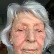 jg before pbm 20 per cent