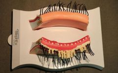 normal vs blepharitis eyelids 30 percent 800x500