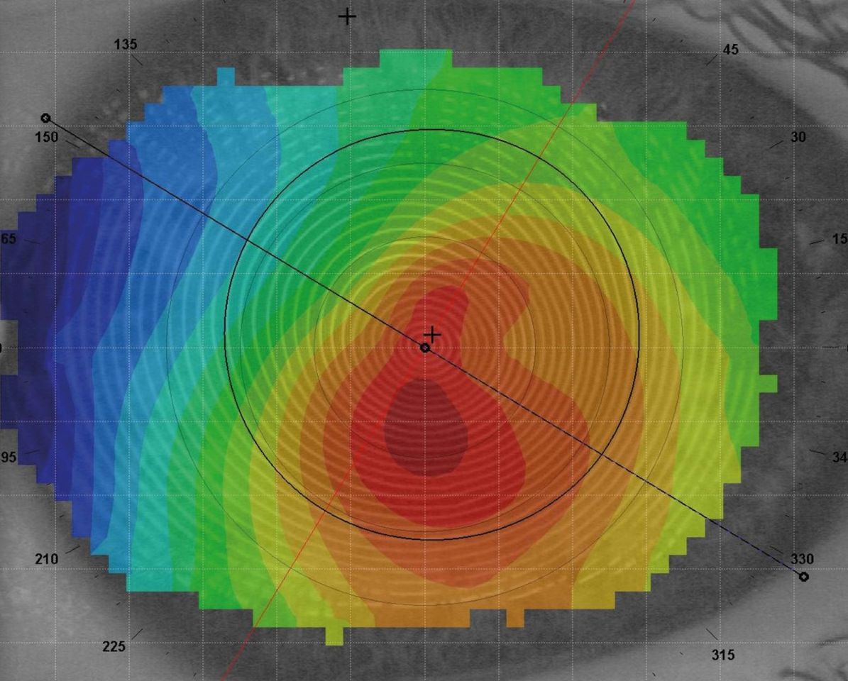 specialist lenses 1344x1080