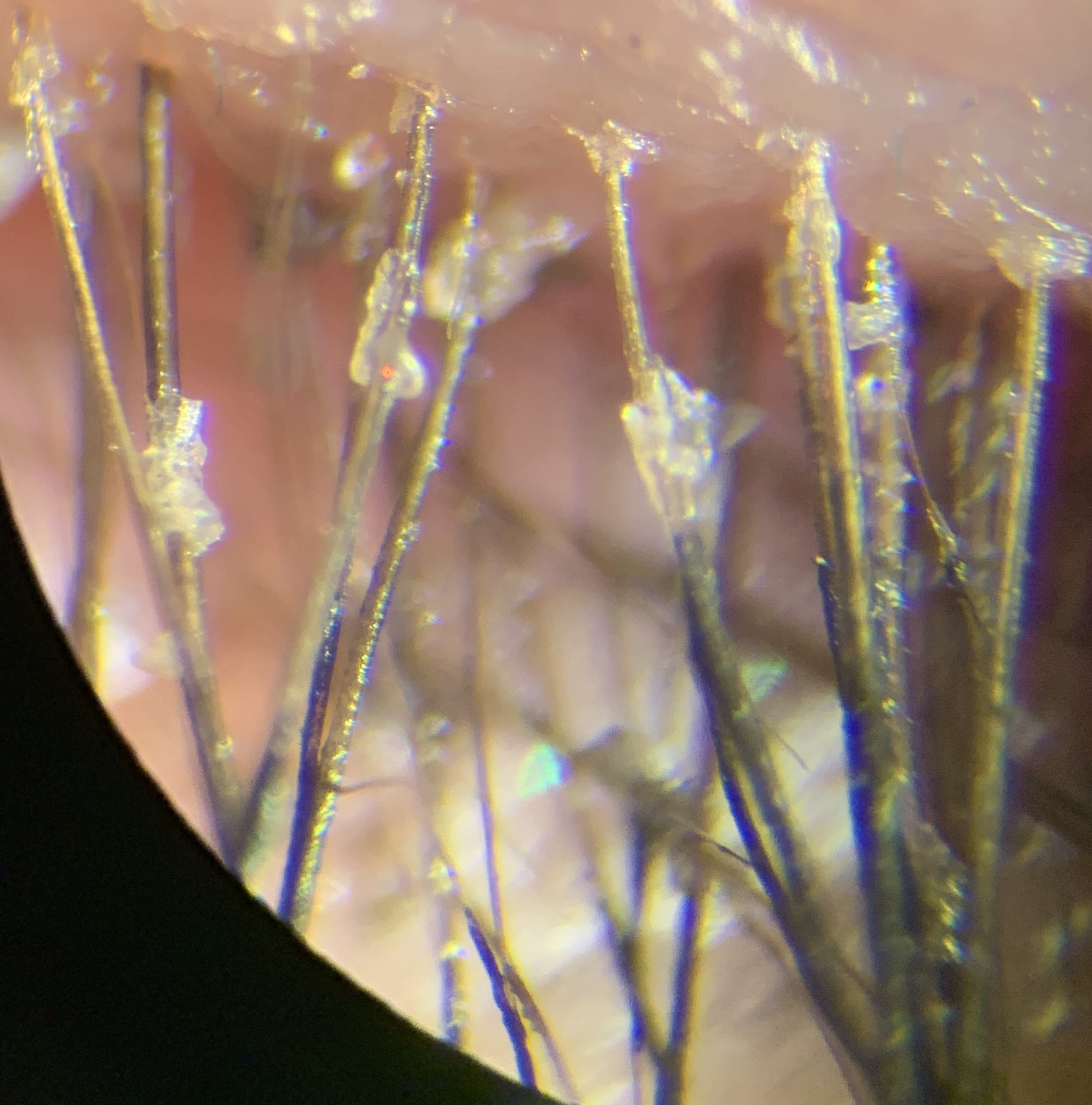 sw le superior lid and lashes edit16 march 2019